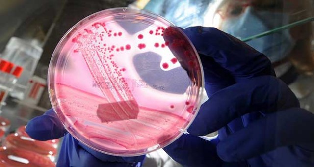 Ölümcül bakteri her an insanlara geçebilir!