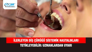 İlerleyen Diş Çürüğü Sistemik Hastalıkları Tetikleyebilir: Uzmanlardan Uyarı